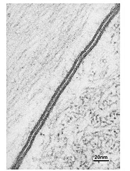 Micrografia eletrônica evidenciando a unidade de membrana