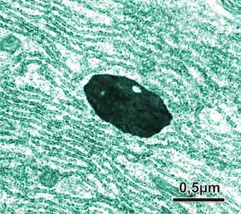 Micrografia eletrônica de um lisossomo de uma célula de glândula salivar de inseto