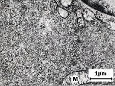 Micrografia eletrônica de uma célula com abundante retículo endoplasmático liso 