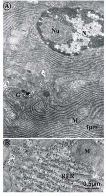 Micrografias eletrônicas mostrando um retículo endoplasmático rugoso (RER)