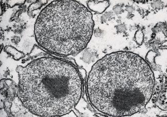 Micrografia eletrônica mostrando os peroxissomos