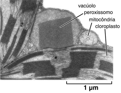 Micrografia eletrônica evidenciando um peroxissomo e sua íntima associação com uma mitocôndria e cloroplastos
