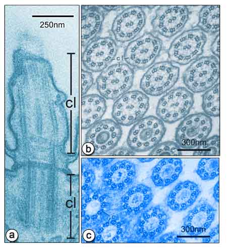 Micrografias eletrônicas de cílios