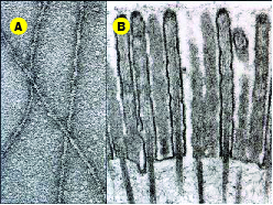 Micrografias eletrônicas de filamentos de actina isolados