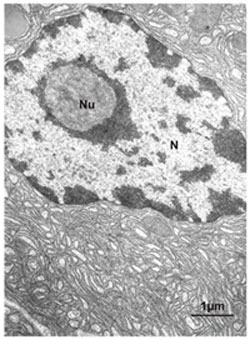 Micrografia eletrônica de uma célula de pâncreas exócrino 