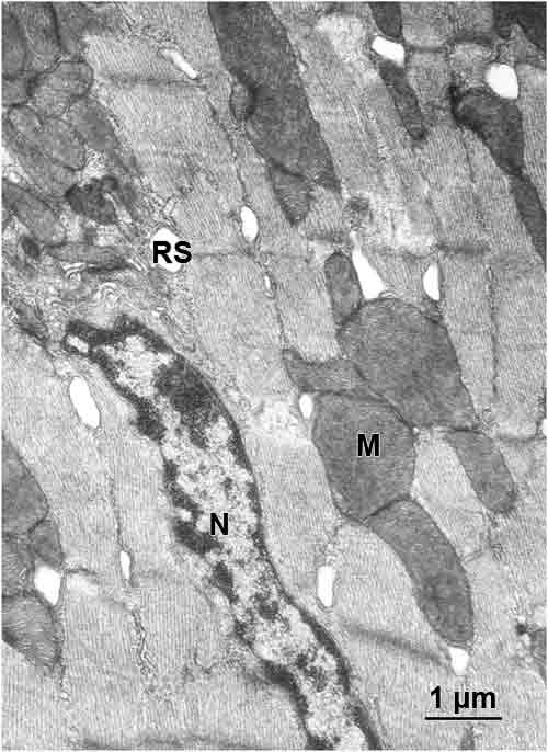 Micrografia eletrônica de uma célula muscular cardíaca
