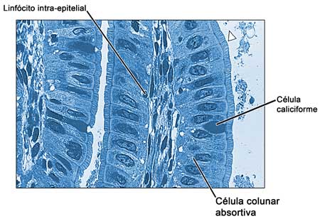 Imagem histológica do epitélio intestinal
