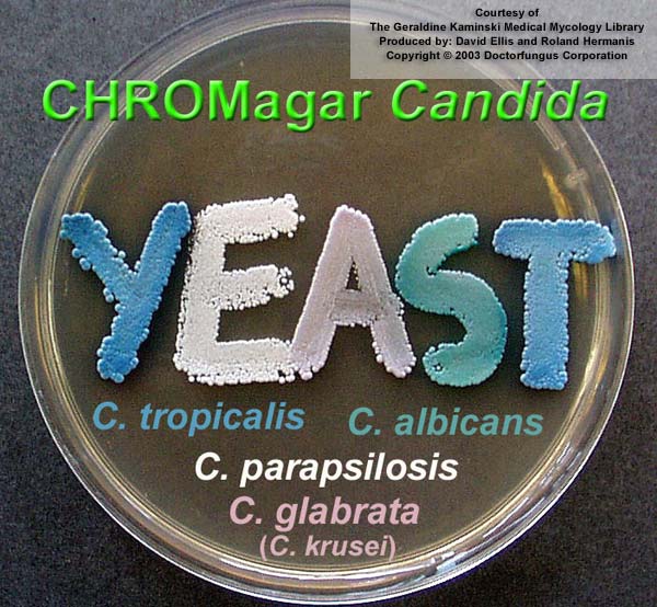 yeast chromagar