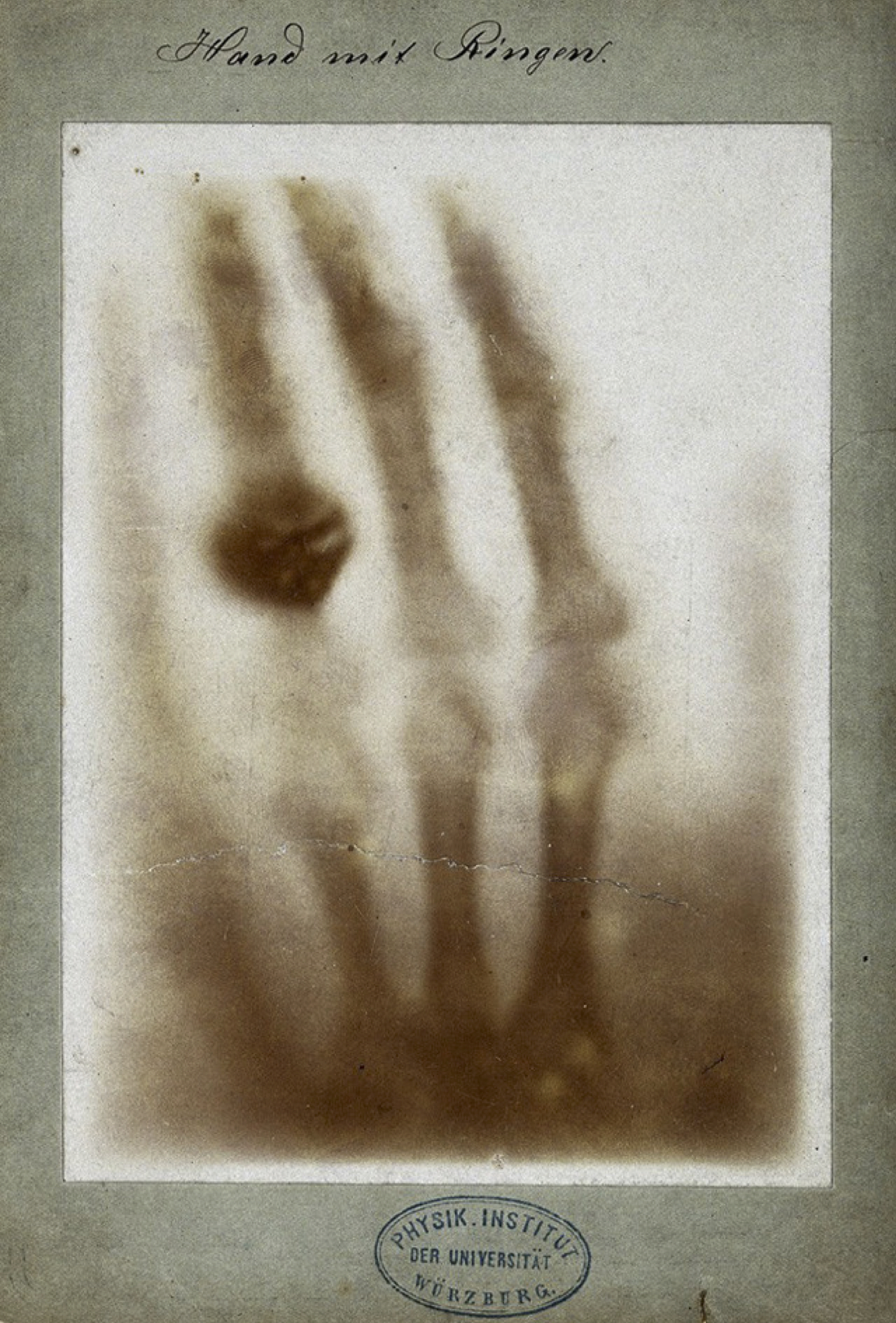 Primeira imagem de raios X