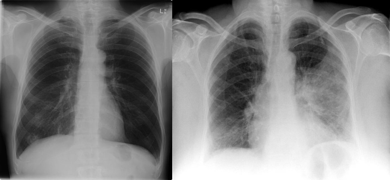 Fig1Prob2Mod16